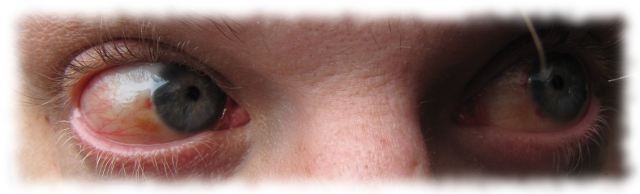 Ulfs Augen, 15. Juli 2011.