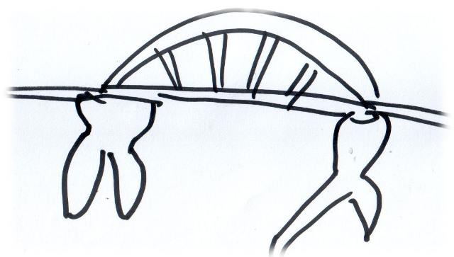 Zahnbrcke