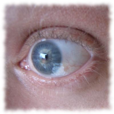 Ulfs Auge, gertet.