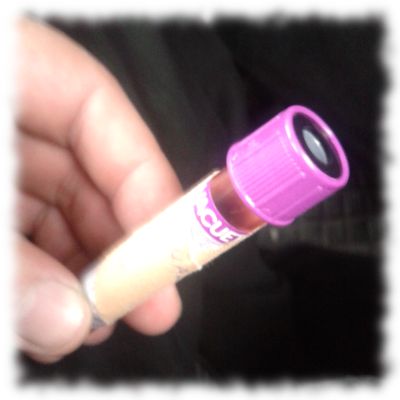 Blutprobe von Aurela.