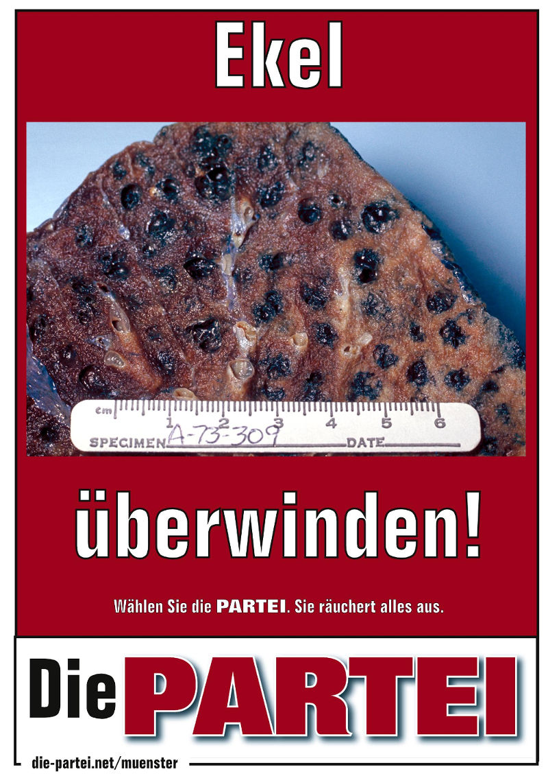 Ekel berwinden! (Bild von Raucherlunge)