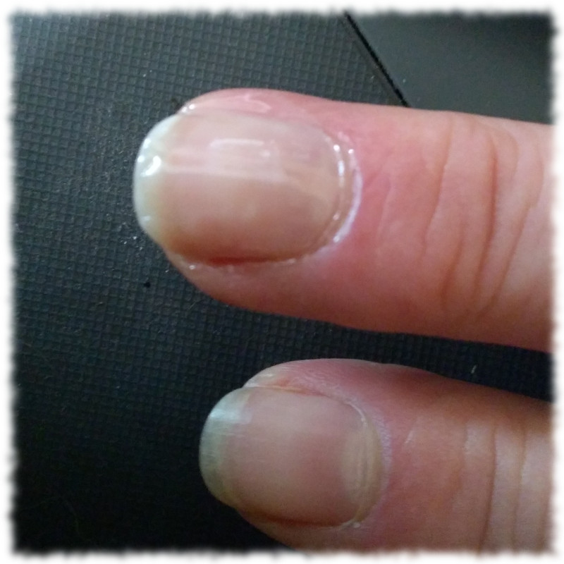 Frisch mit Nagelhrter lackierter Mittelfingernagel