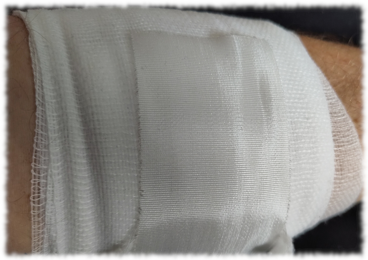 Unterarm mit frischem sauberen Verband